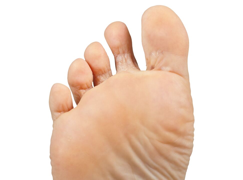 Funer-Good-Pair-Y-Hektik-Crem-Demyxil