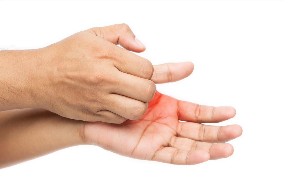 Juckreiz mit Pilzen und seiner Behandlung mit Demyxil -Creme